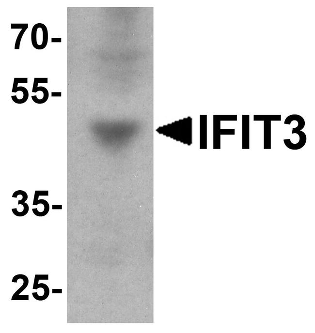 IFIT3 Antibody in Western Blot (WB)