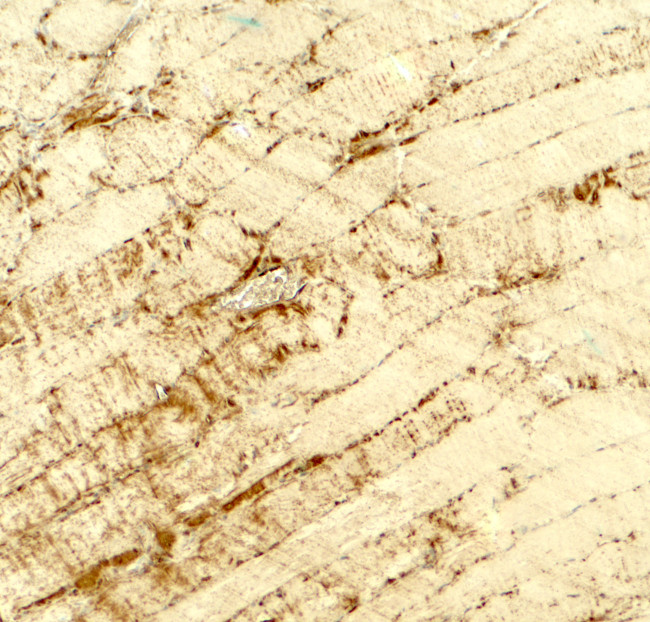 DCANP1 Antibody in Immunohistochemistry (Paraffin) (IHC (P))