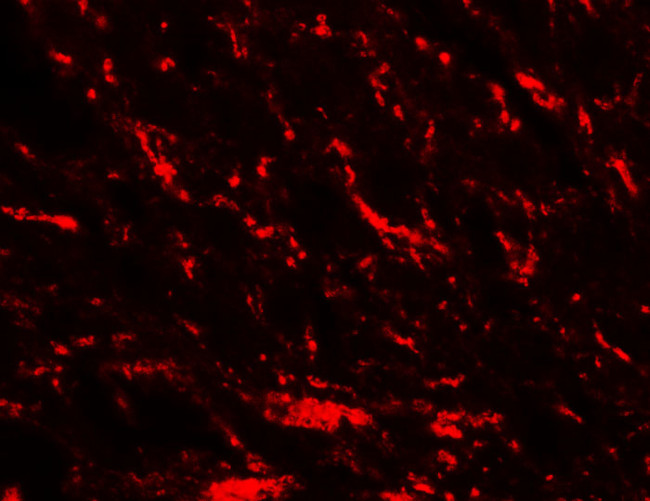 MFN2 Antibody in Immunohistochemistry (Paraffin) (IHC (P))