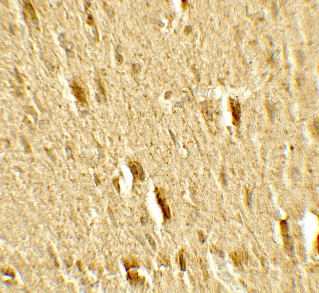 MFN2 Antibody in Immunohistochemistry (Paraffin) (IHC (P))