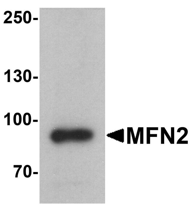 MFN2 Antibody in Western Blot (WB)