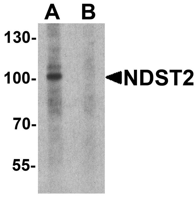 NDST2 Antibody in Western Blot (WB)