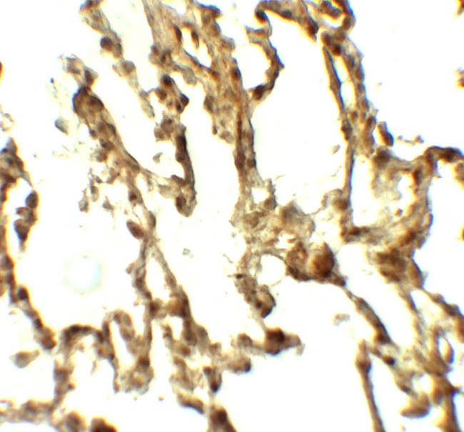 ATG4C Antibody in Immunohistochemistry (Paraffin) (IHC (P))