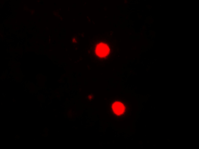 SOX17 Antibody in Immunohistochemistry (IHC)