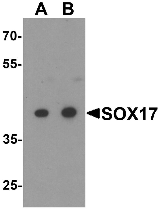 SOX17 Antibody in Western Blot (WB)