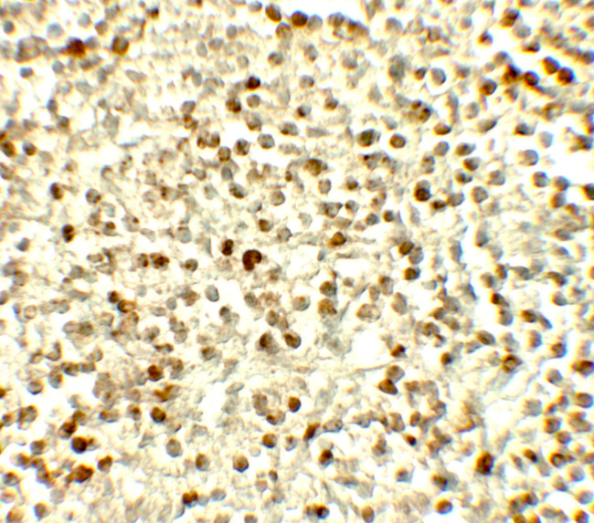 NOX4 Antibody in Immunohistochemistry (Paraffin) (IHC (P))