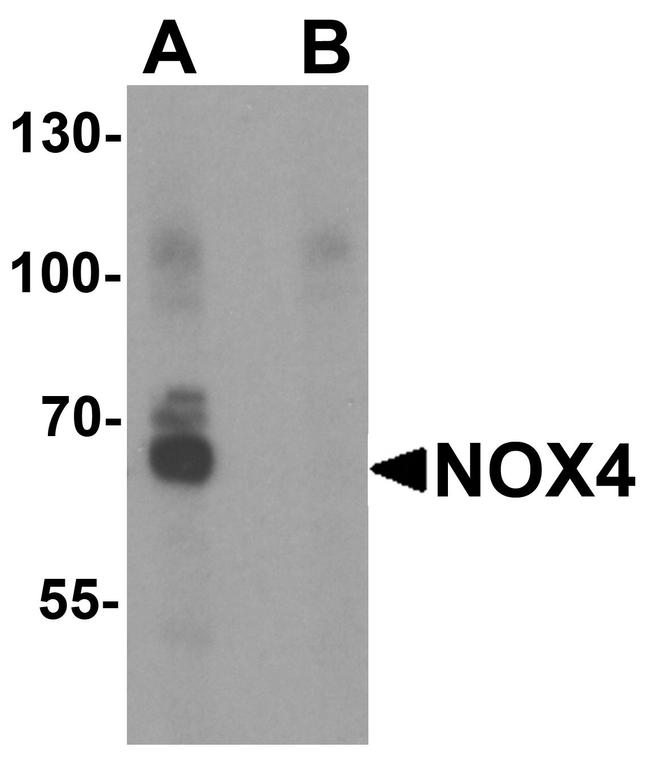 NOX4 Antibody in Western Blot (WB)