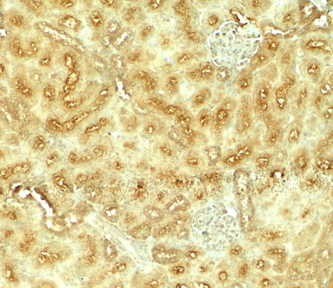 Vezatin Antibody in Immunohistochemistry (Paraffin) (IHC (P))