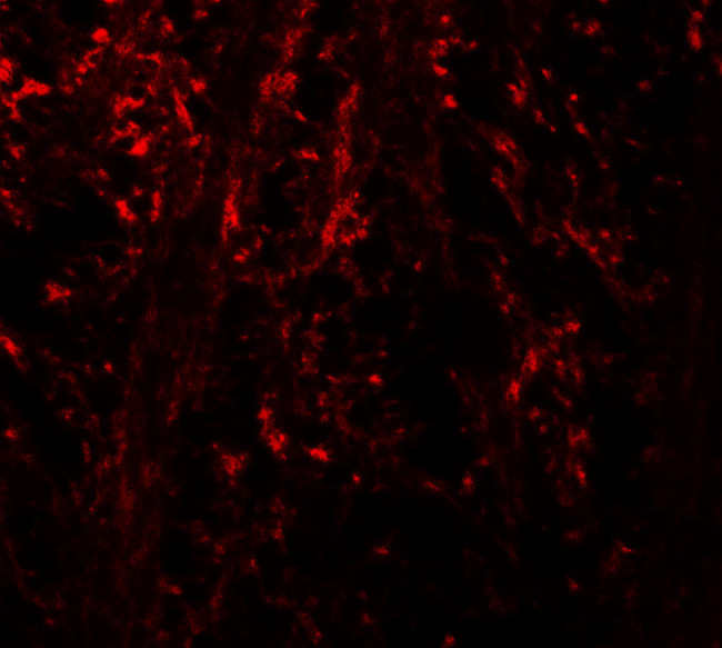 Ninjurin 1 Antibody in Immunohistochemistry (Paraffin) (IHC (P))