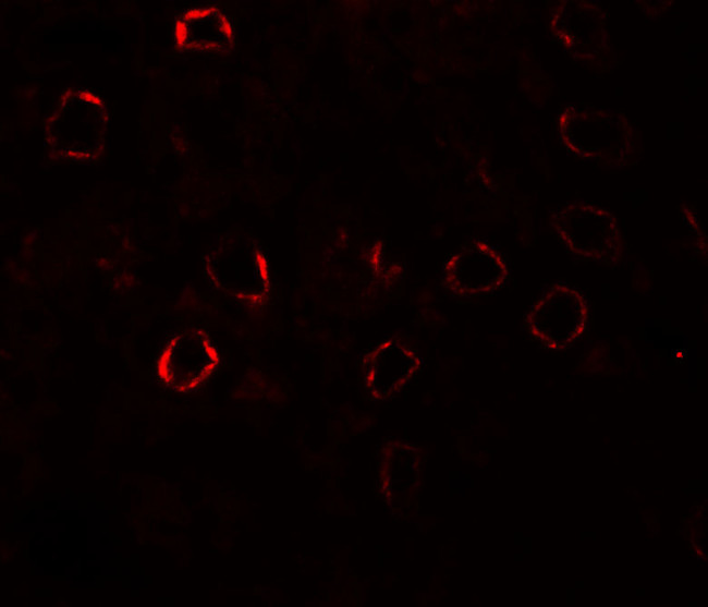 KIRREL3 Antibody in Immunohistochemistry (Paraffin) (IHC (P))