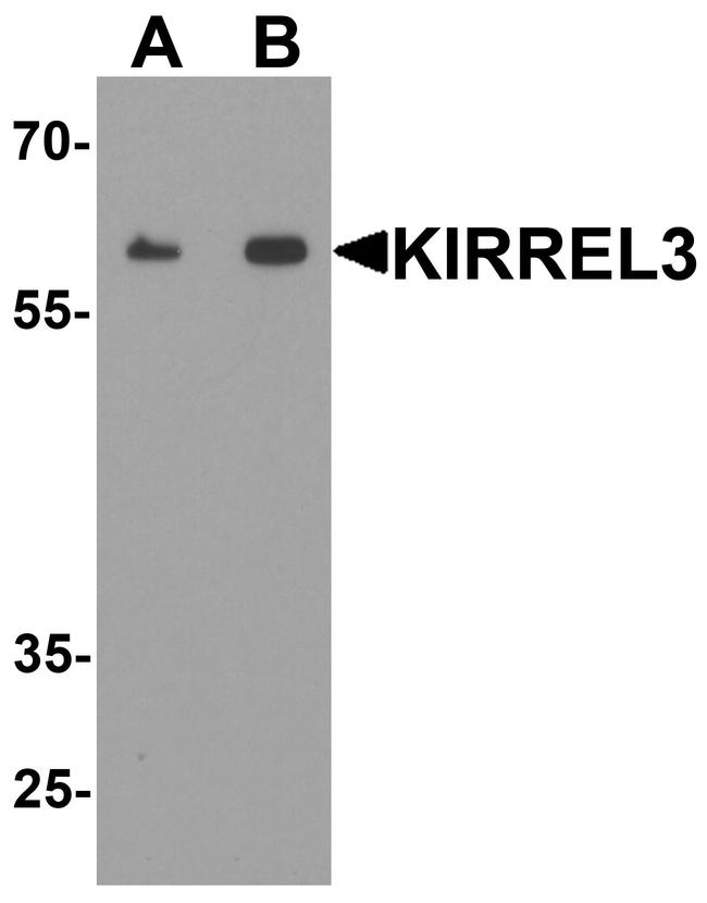 KIRREL3 Antibody in Western Blot (WB)