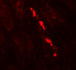 Nephrin Antibody in Immunohistochemistry (Paraffin) (IHC (P))