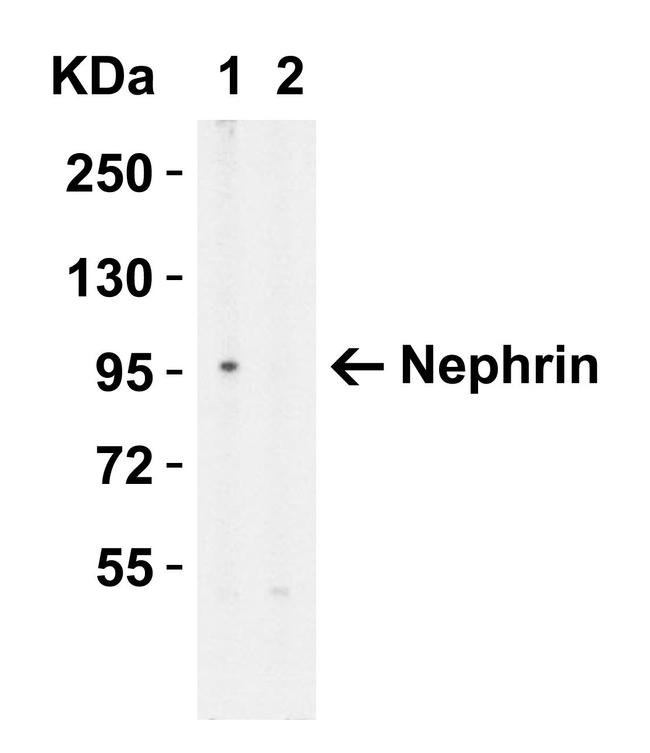 Nephrin Antibody in Western Blot (WB)