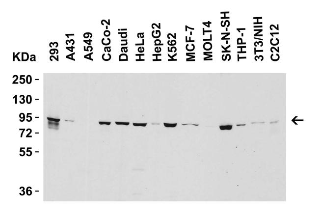 Nephrin Antibody in Western Blot (WB)