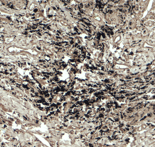 Beclin 2 Antibody in Immunohistochemistry (Paraffin) (IHC (P))