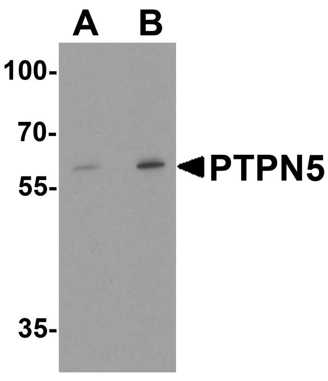 STEP Antibody in Western Blot (WB)