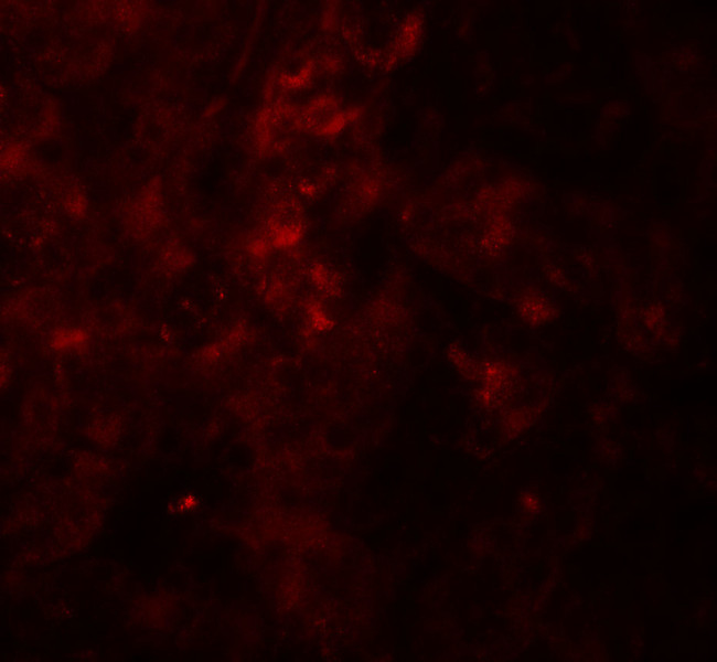 SESN2 Antibody in Immunohistochemistry (Paraffin) (IHC (P))