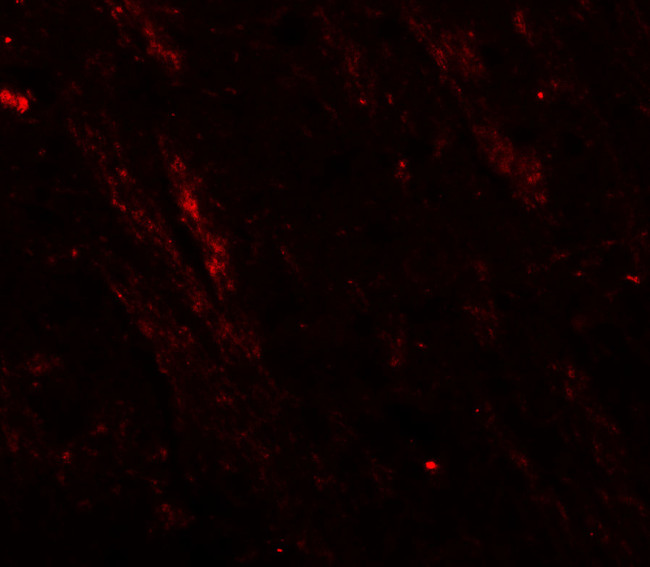 CaV3.2 Antibody in Immunohistochemistry (Paraffin) (IHC (P))