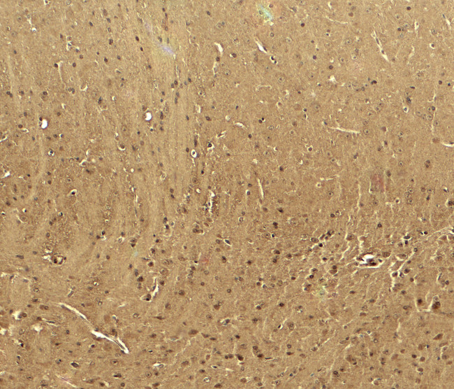 CaV3.2 Antibody in Immunohistochemistry (Paraffin) (IHC (P))