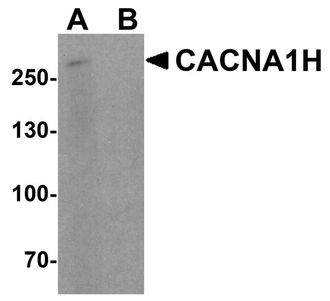 CaV3.2 Antibody in Western Blot (WB)