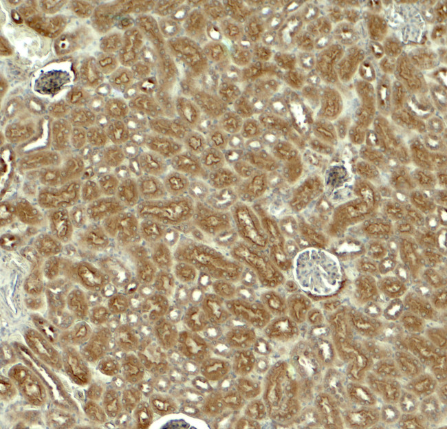 EDA Antibody in Immunohistochemistry (Paraffin) (IHC (P))