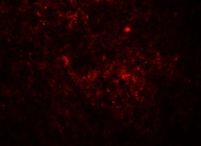 Jagged1 Antibody in Immunohistochemistry (Paraffin) (IHC (P))