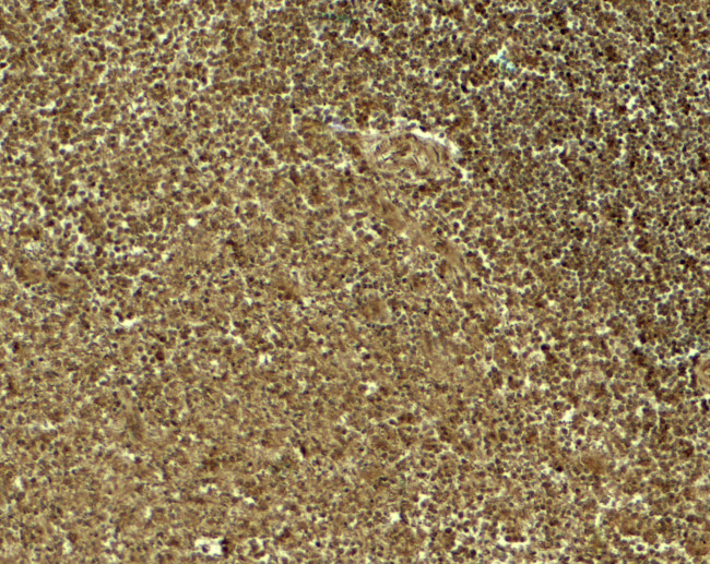 Jagged1 Antibody in Immunohistochemistry (Paraffin) (IHC (P))