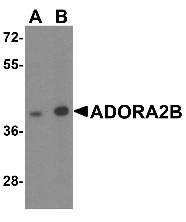 ADORA2B Antibody in Western Blot (WB)