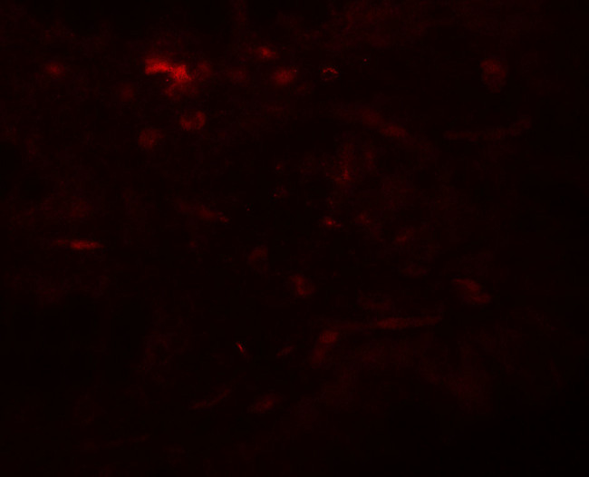 WSB1 Antibody in Immunohistochemistry (Paraffin) (IHC (P))