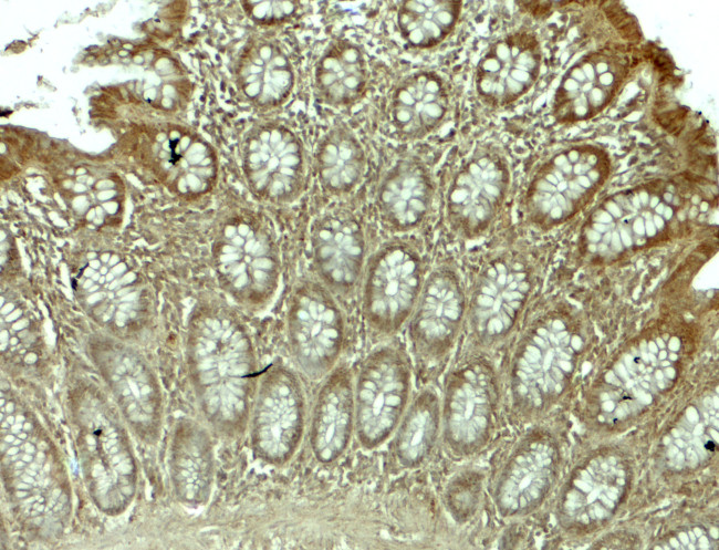 WSB1 Antibody in Immunohistochemistry (Paraffin) (IHC (P))