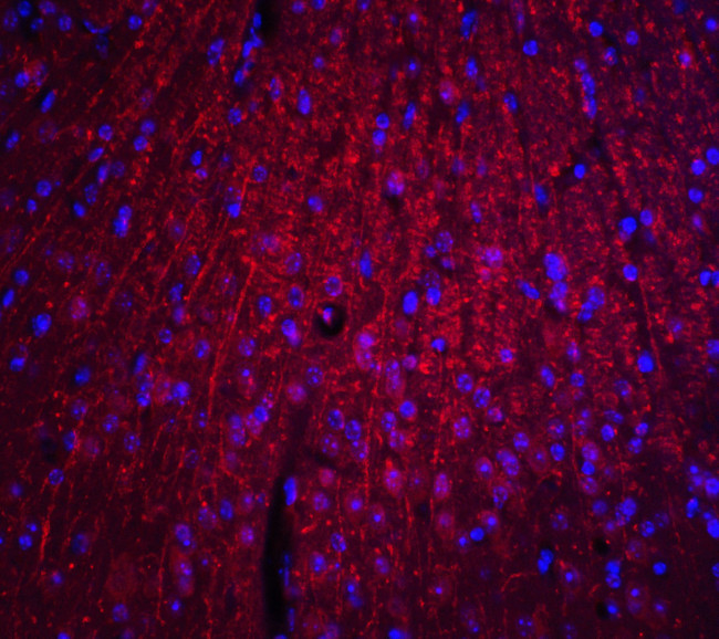 ARID1A Antibody in Immunohistochemistry (Paraffin) (IHC (P))