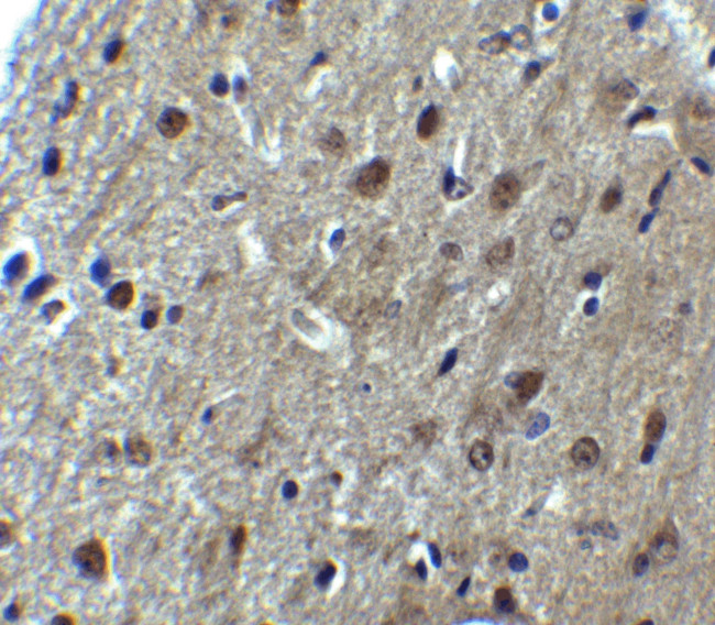 ARID1A Antibody in Immunohistochemistry (Paraffin) (IHC (P))