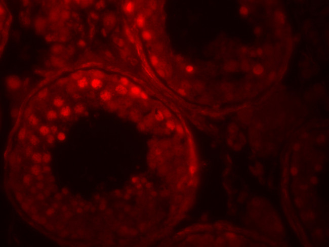 ADAM29 Antibody in Immunohistochemistry (Paraffin) (IHC (P))