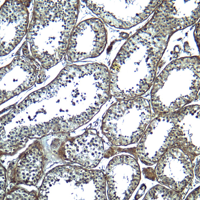 ADAM29 Antibody in Immunohistochemistry (Paraffin) (IHC (P))