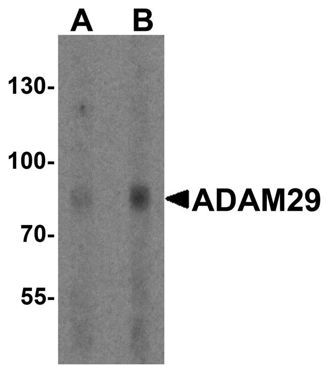 ADAM29 Antibody in Western Blot (WB)