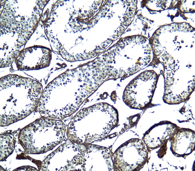 UBD Antibody in Immunohistochemistry (Paraffin) (IHC (P))