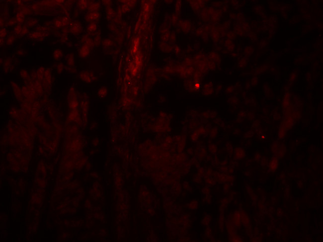 PACS1 Antibody in Immunohistochemistry (IHC)