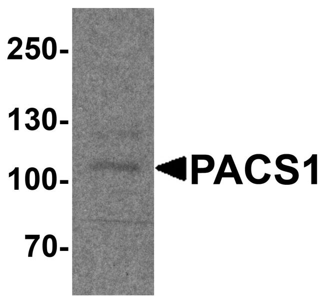 PACS1 Antibody in Western Blot (WB)