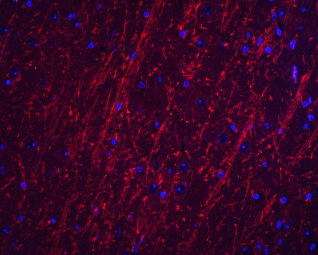 PACS2 Antibody in Immunohistochemistry (Paraffin) (IHC (P))