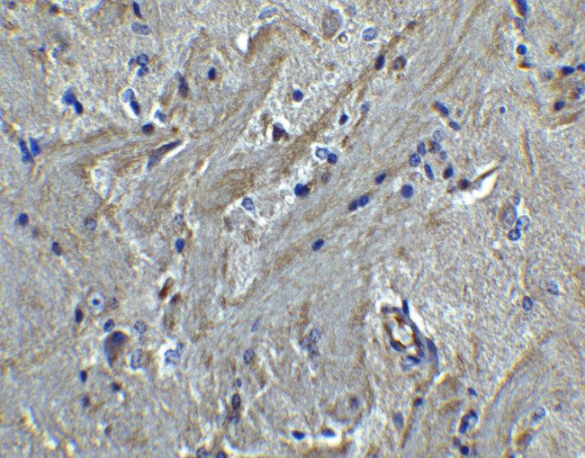 PACS2 Antibody in Immunohistochemistry (Paraffin) (IHC (P))