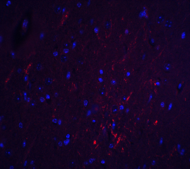 S1PR2 Antibody in Immunohistochemistry (Paraffin) (IHC (P))