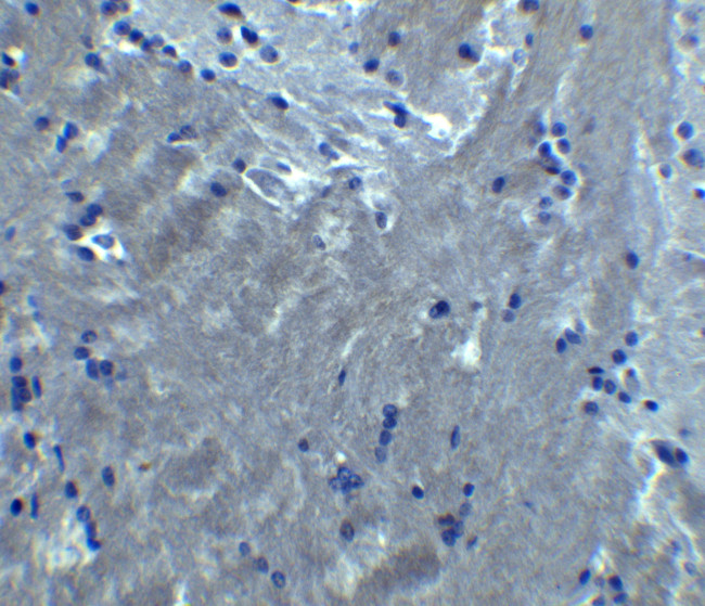 S1PR2 Antibody in Immunohistochemistry (Paraffin) (IHC (P))