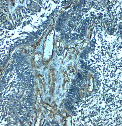 PALMD Antibody in Immunohistochemistry (Paraffin) (IHC (P))