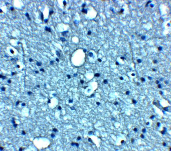 VTI1B Antibody in Immunohistochemistry (Paraffin) (IHC (P))