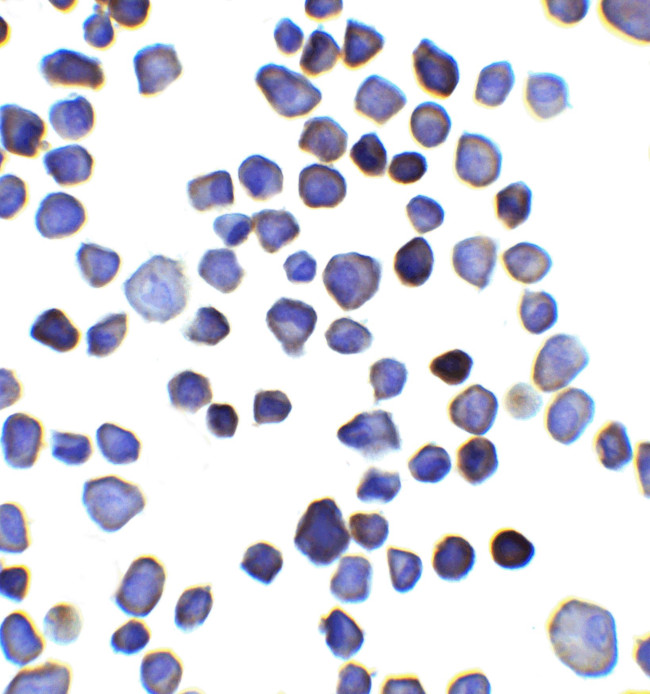 INPP4B Antibody in Immunocytochemistry (ICC/IF)