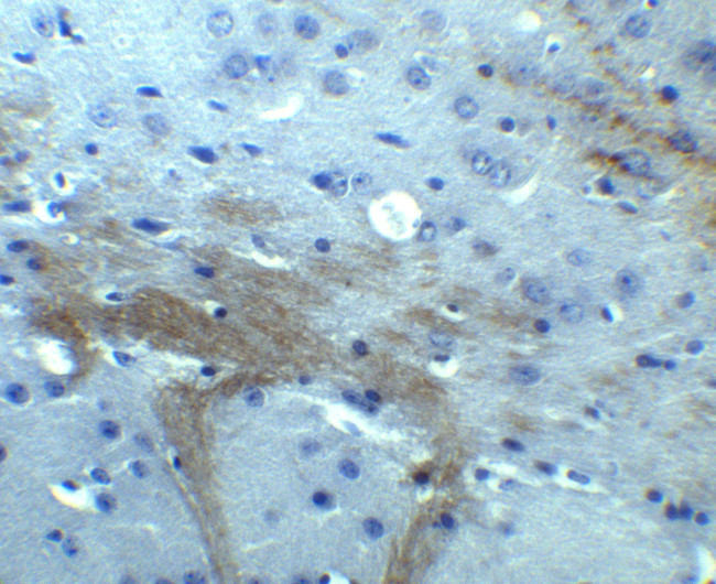 TNFAIP1 Antibody in Immunohistochemistry (Paraffin) (IHC (P))