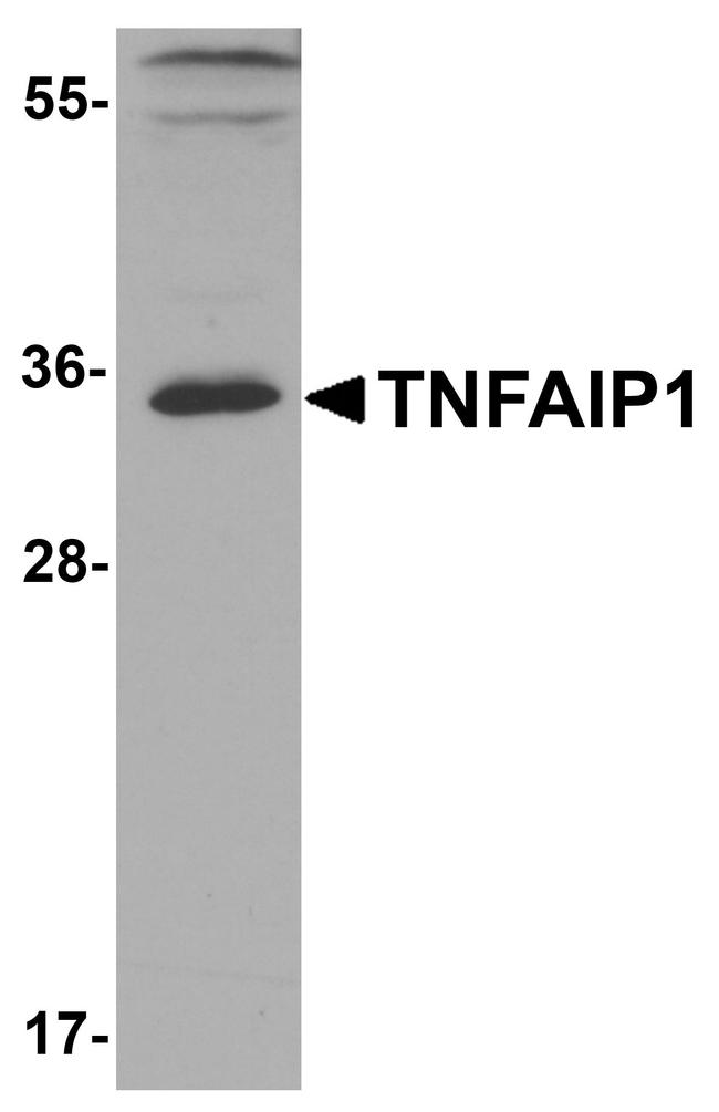 TNFAIP1 Antibody in Western Blot (WB)