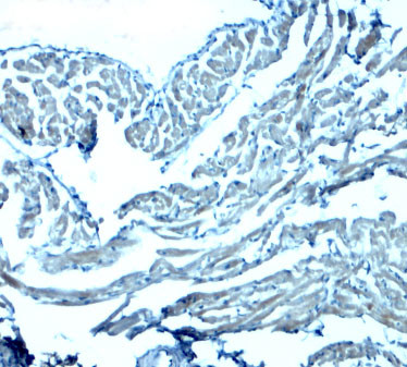 GAS6 Antibody in Immunohistochemistry (Paraffin) (IHC (P))