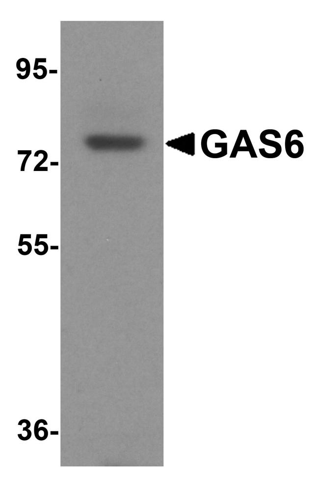 GAS6 Antibody in Western Blot (WB)