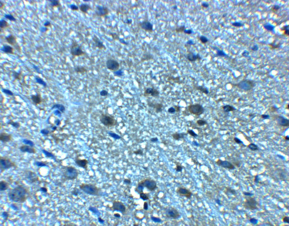 LANCL2 Antibody in Immunohistochemistry (Paraffin) (IHC (P))